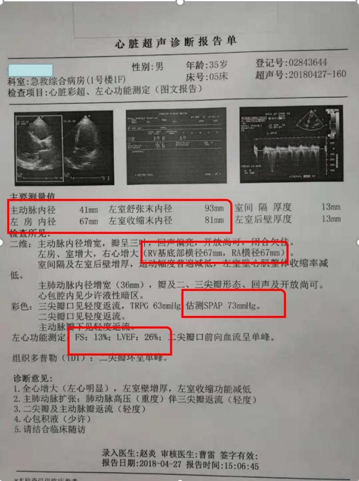 专家讲解arni药治疗心衰病例,抗心衰药物arni
