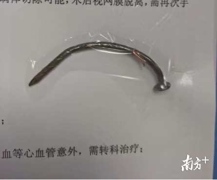 惊悚！佛山一妇女工作时不慎被8cm生锈铁钉穿眼