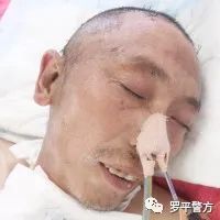高处摔下昏迷然后做开颅手术,爸爸意外摔伤开颅手术昏迷