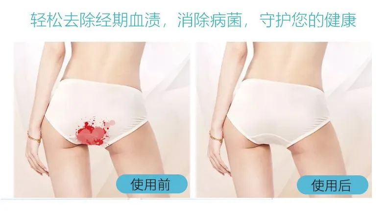 洗衣时加白醋好不好,洗衣时加白醋去静电吗