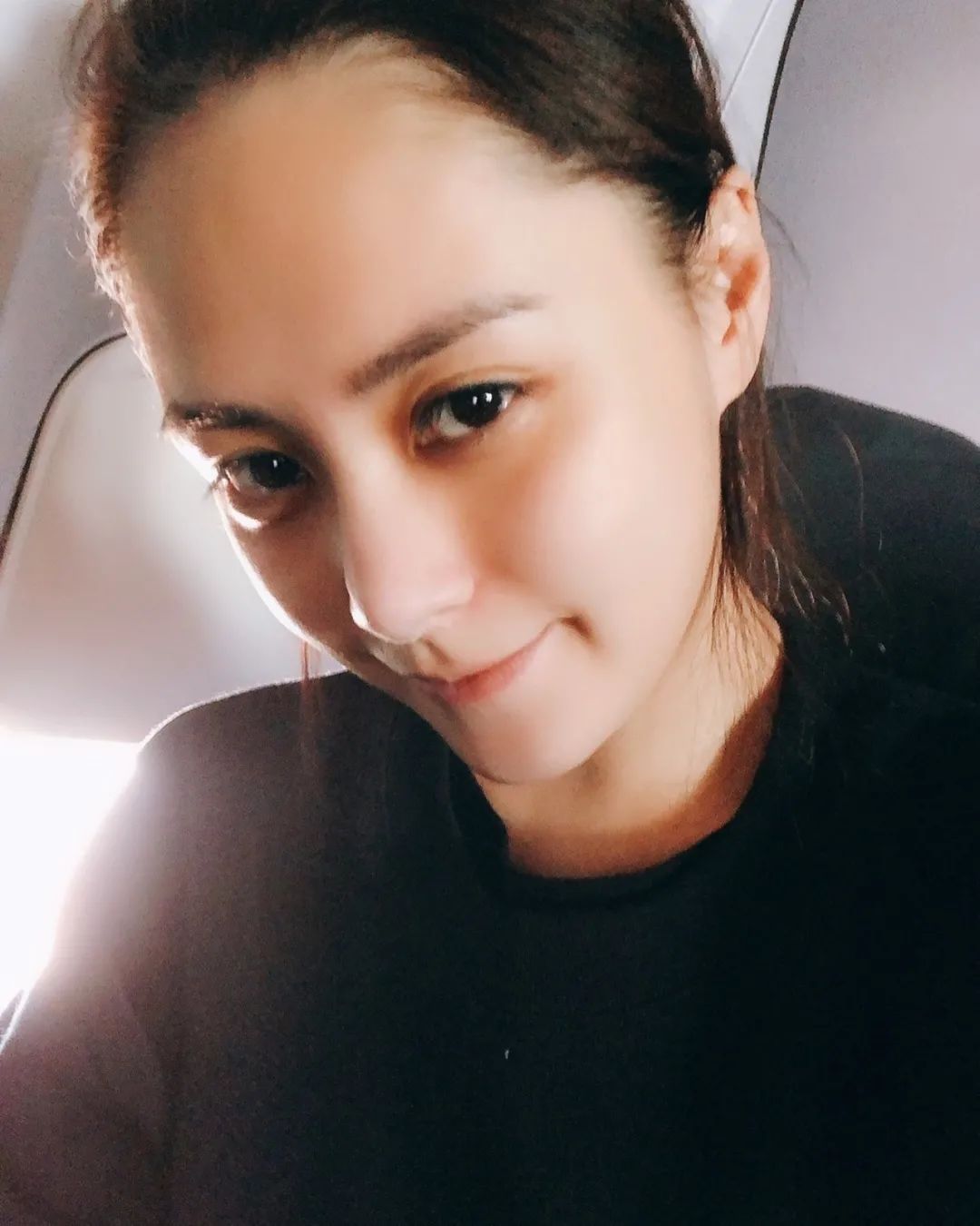 阿娇跌倒受伤,阿娇撞到额头