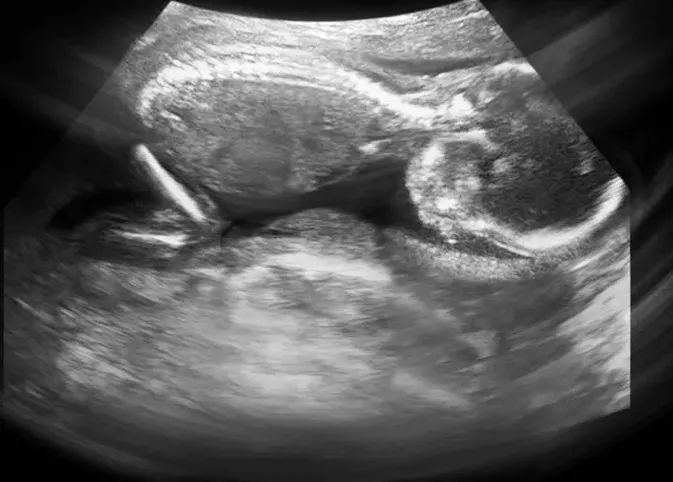 健康一点通怎么查看体检报告,健康孕检单视频