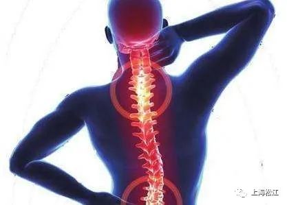 好的颈椎治疗枕头,神经根型颈椎病适合枕哪种枕头