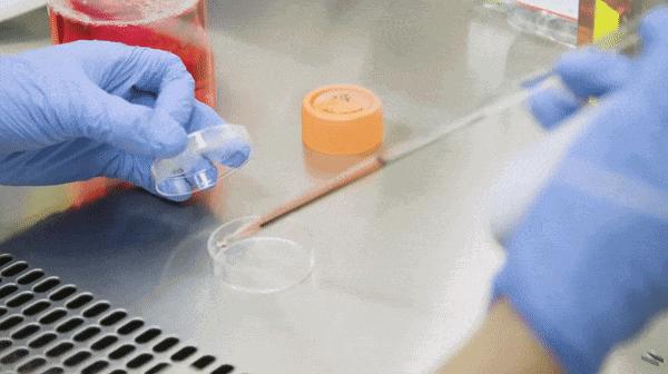 感觉嘴里有股肠胃的臭味,肠胃有一股腐臭味怎么回事