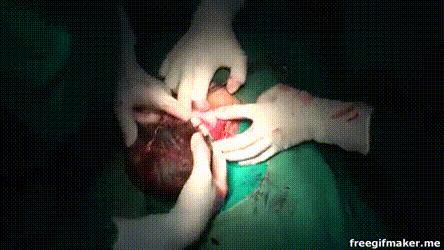 【惊呆】不想要处女座宝宝，明星夫妻提前两周剖腹产！网友：还有这种操作？