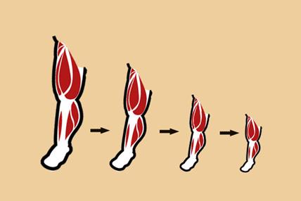 为啥肌肉会萎缩,臀部肌肉稍萎缩