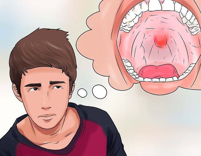 青霉素导致的精神异常怎么办,青少年长效青霉素会有后遗症吗