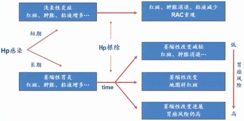 CGC2020|吕宾教授：Hp根除对胃黏膜的影响（附内镜下图像）