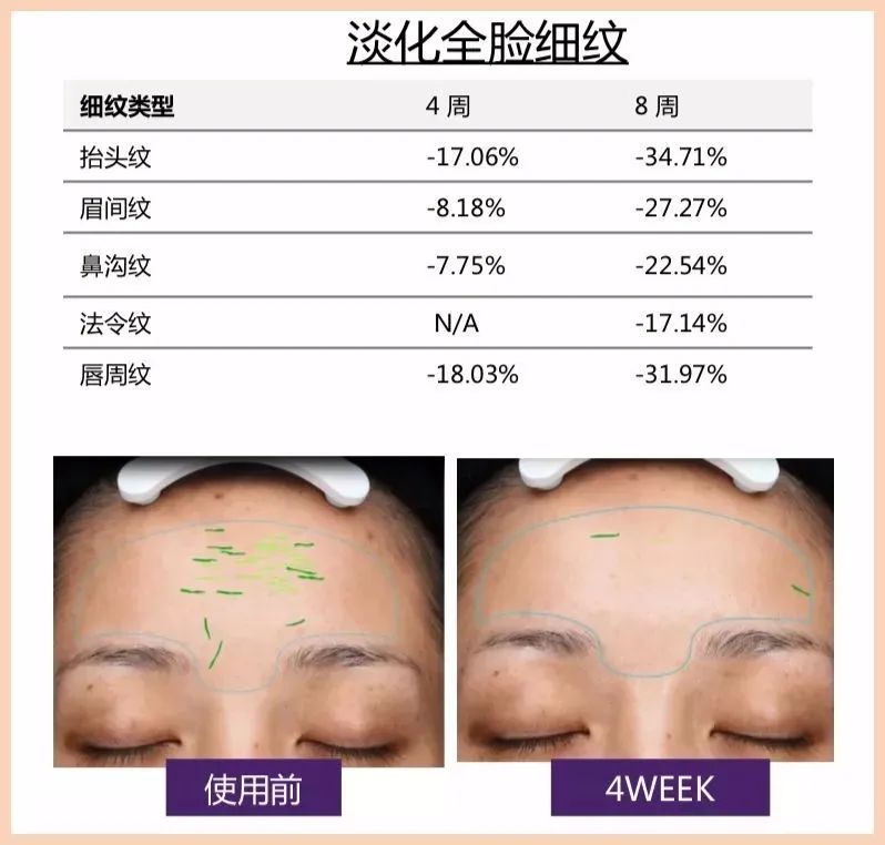 眼霜排行榜前十名欧莱雅紫熨斗,推荐眼霜欧莱雅紫熨斗