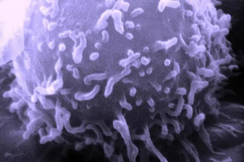 cell癌细胞,cell癌症