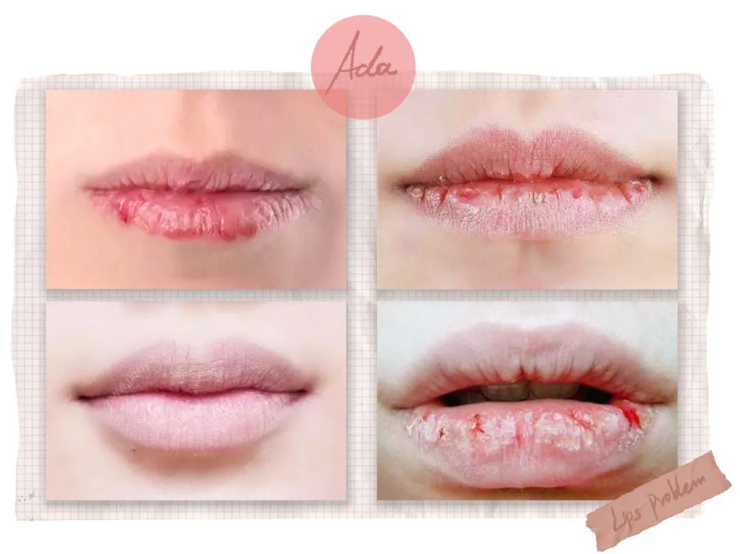 “唇膏买错会致癌！”：选东西，一定要看成分