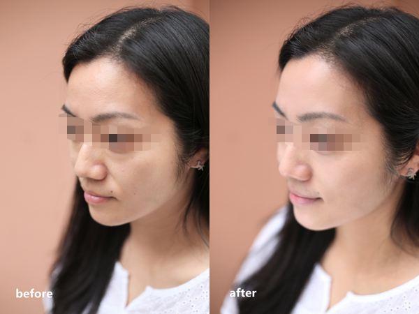 秋冬泡脚有多重要,秋冬季节最适合什么泡脚