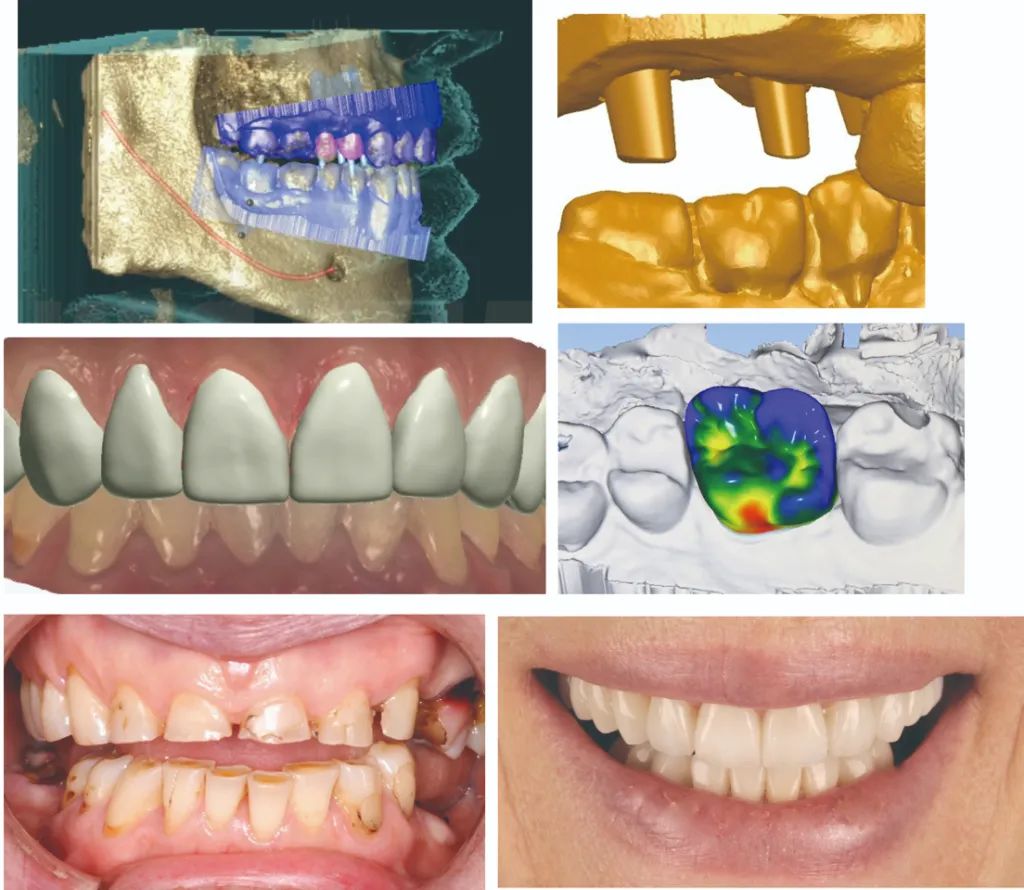 “牙相”大师：一颗牙阅读你的一生