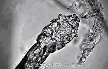 火遍全网的生发养发防脱固发,去屑止痒防脱养发