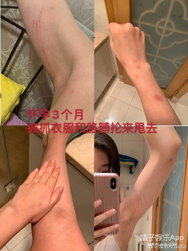 张培萌妻子谈被家暴,张培萌妻子首谈家暴细节全视频