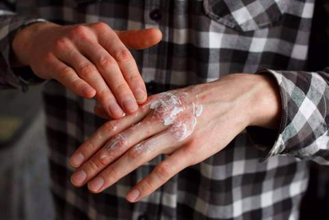 为啥脸上皮炎湿疹会反复发作呢,老年人反复皮炎湿疹怎么办