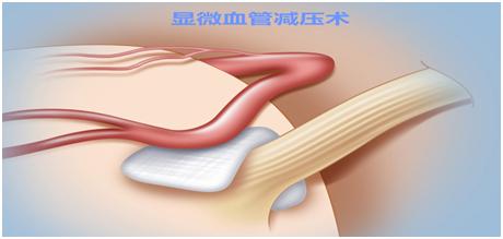 眼皮跳吉凶是真的吗,眼皮跳24小时吉凶预兆