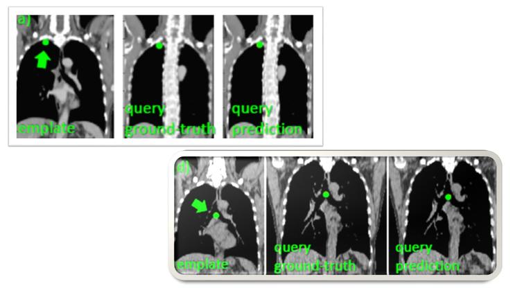 陆菁菁北京协和医院,陆菁菁和睦家