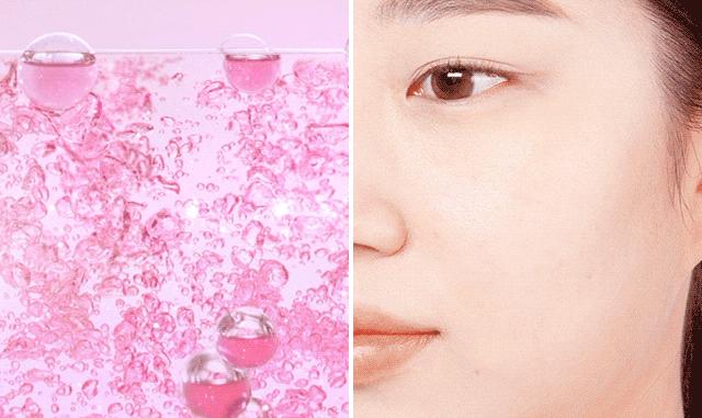 花了3万做激光，才彻底懂了：医生为什么劝你别去斑