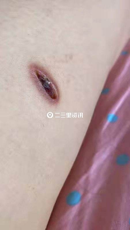 女子找技师做产后修复结果震惊了,女子找技师做产后修复结果气炸