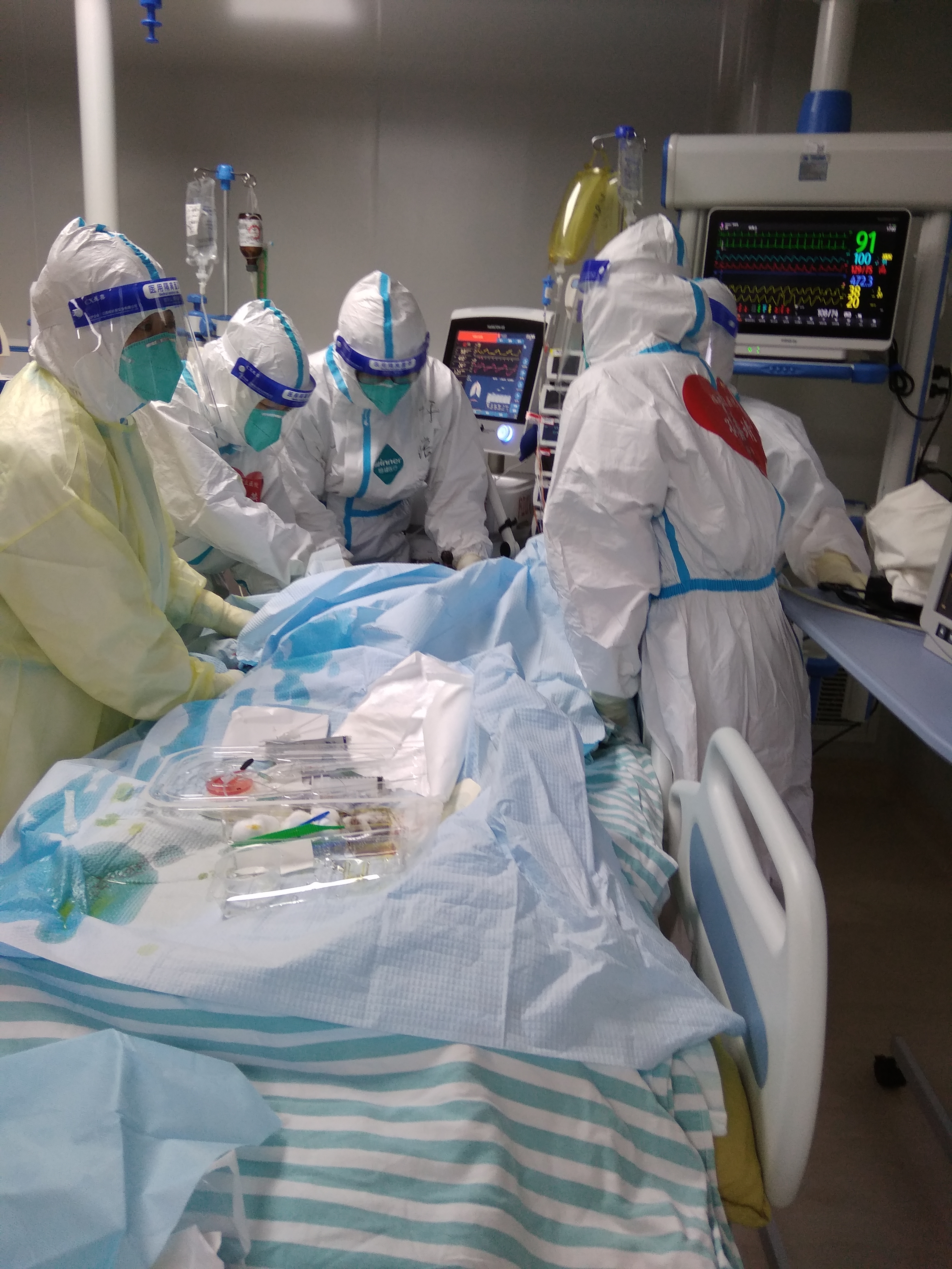 新冠肺炎患者生命通道,一根钢管贯穿医生却靠经验救人