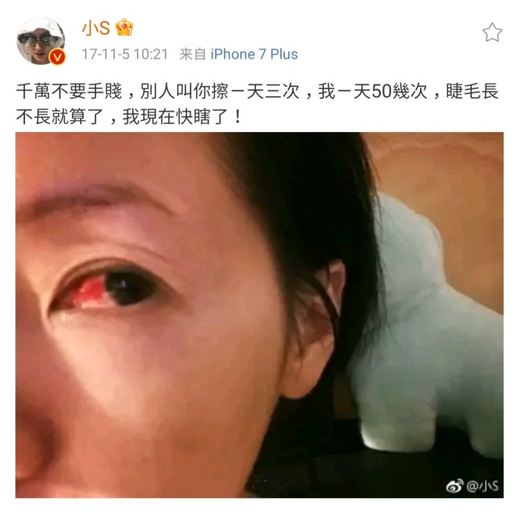 精灵般的睫毛，是眼睛自带的滤镜