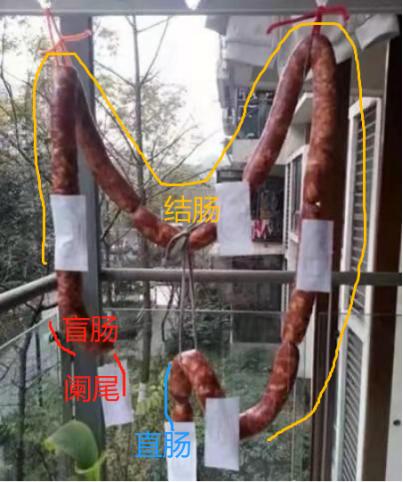 海椒吃得多，肠癌跑不脱？华西医生说：吓得我搞紧又切捻了顿火锅！