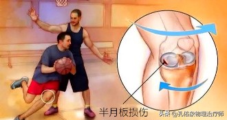 膝关节疼痛需不需要重视,膝盖疼痛不要忍