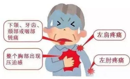 通心络胶囊益心舒,通心络胶囊的功效与主治是什么