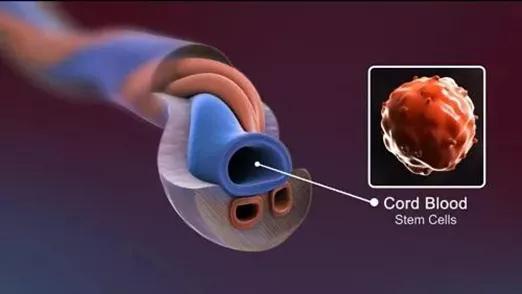 人一生仅有一次的救命脐带血，到底要不要存？