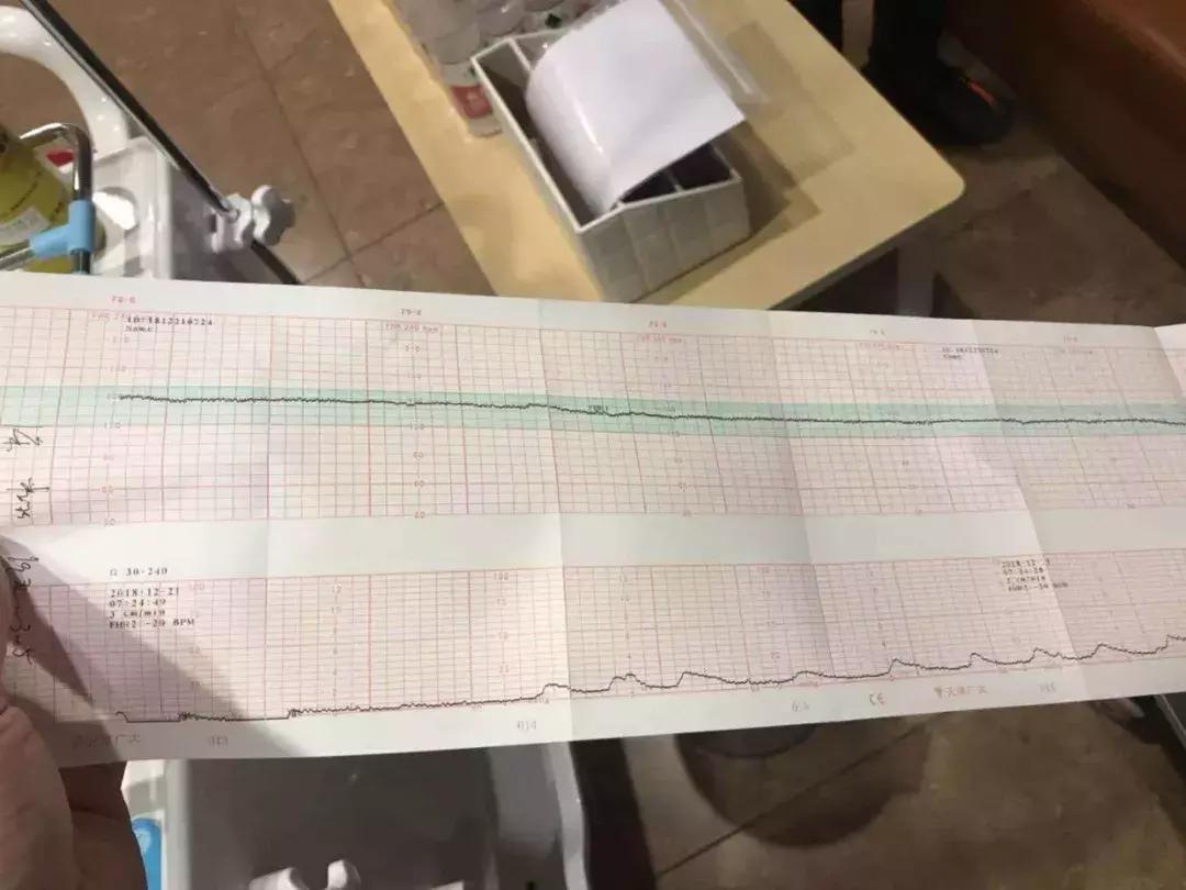 点赞丨紧急！高龄妈妈胎监图呈直线，多团队协作小天使平安降临