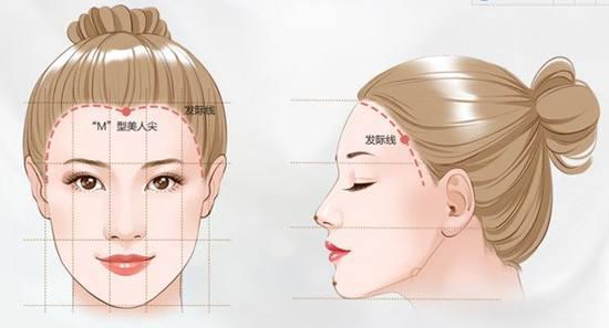 发际线高怎么办用什么药,发际线高怎么办改善