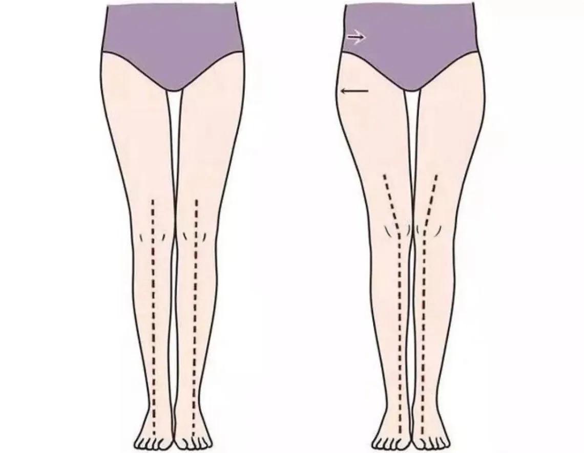 让腿又细又长,怎样锻炼可以改善假胯宽大粗腿