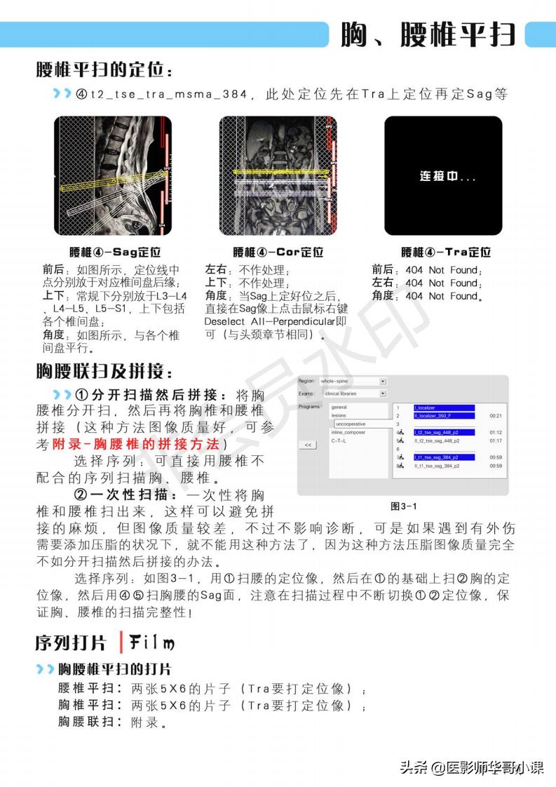 磁共振扫描技术西门子,西门子磁共振最新操作界面