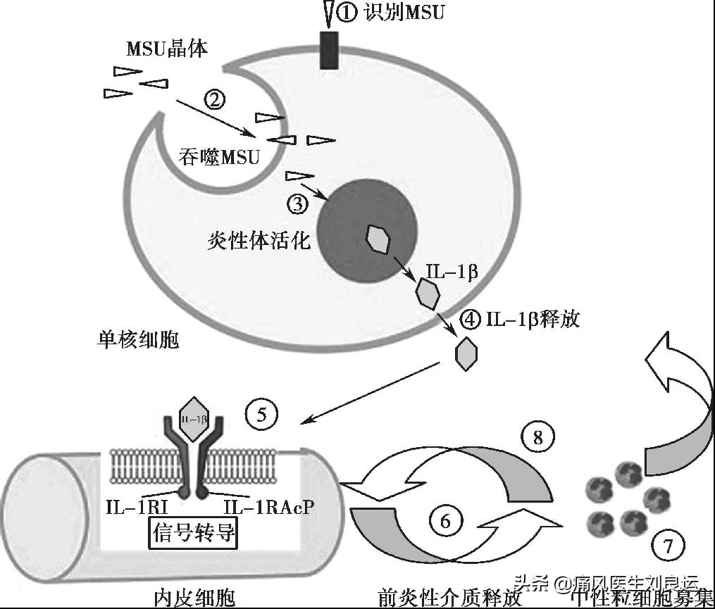 痛风吃什么中药有效治好,痛风吃什么药最快缓解