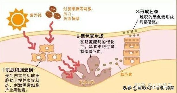 去痘印产品终极盘点，这几款效果肉眼可见！网友：价格效果成正比
