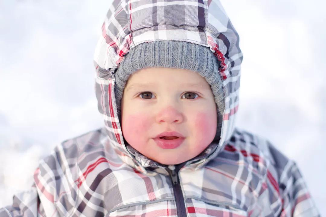宝宝皮肤溃烂反复无法愈合,婴儿皮肤溃烂怎么治疗最有效