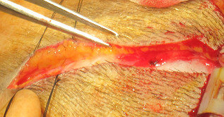 肉毒素打鱼尾纹范围大注射点图解,鱼尾纹肉毒素的危害和后遗症