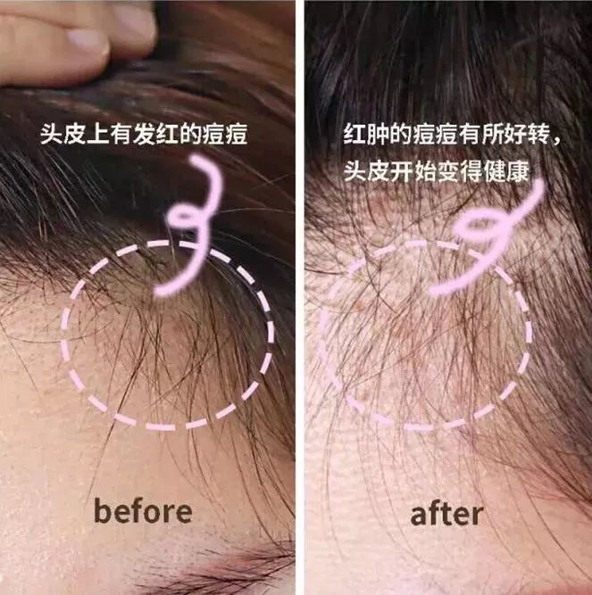 2021年平价去屑洗发水推荐测评,好的洗发水去屑顺滑蓬松控油止痒