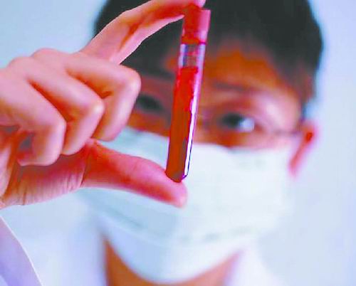 抽血发生凝固的原因都有哪些？