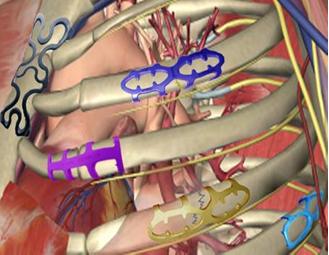 健康科普正确认识骨折才能好得快,正确认识尾椎骨疼痛