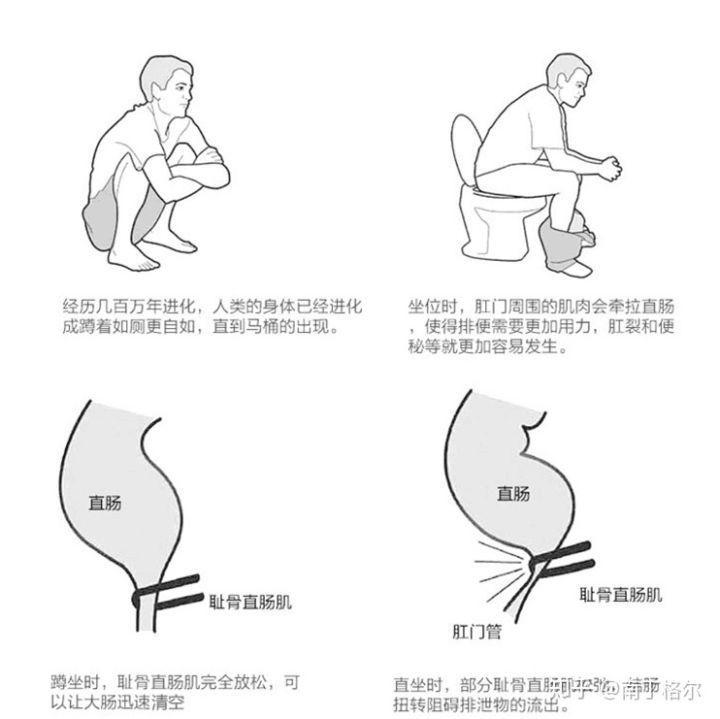 反复肛裂不见好怎么办,肛裂为啥老是开裂和痒