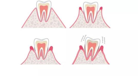松了的牙齿好痒怎么办,松了两年的牙齿还可以补救吗