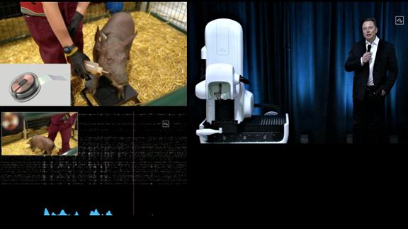 马斯克演示脑机接口植入猪脑,马斯克与比尔盖茨对人类的贡献