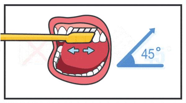 孕期牙疼是什么原因引起的,孕期导致的牙疼多久能好
