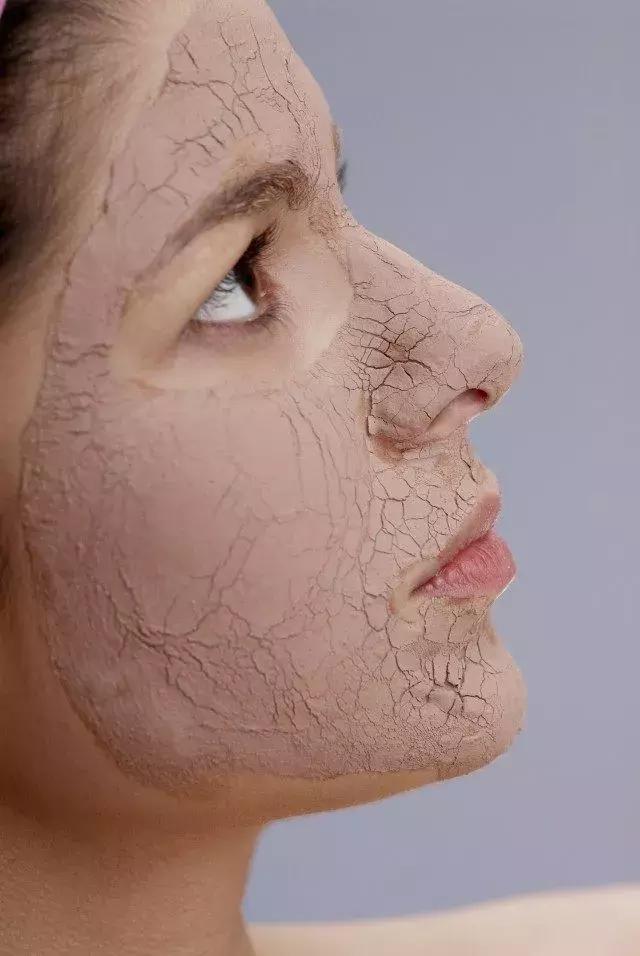 眼皮一抹护肤品就有刺痛感怎么办,刷酸后为什么用护肤品有刺痛感呢