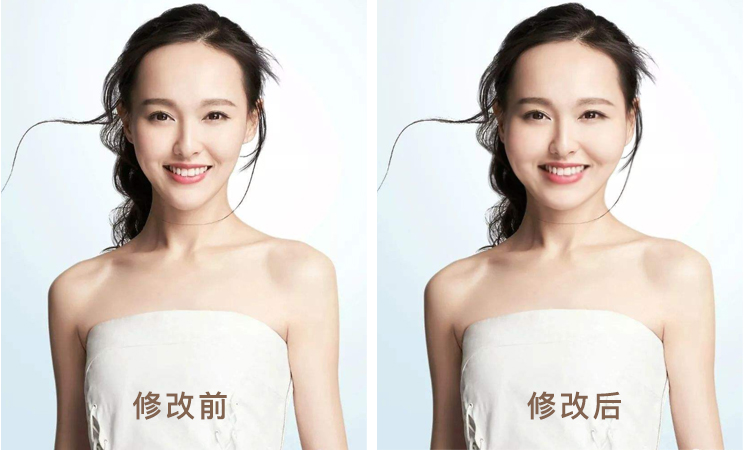 发际线到底怎样才好看,为什么有人的发际线好看