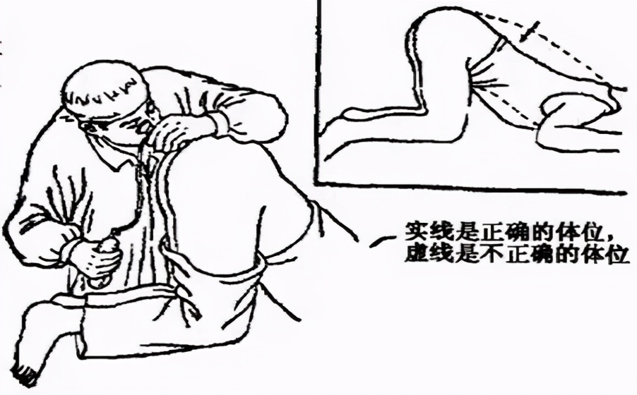 据说这就是肛拭子采样后的样子，有点方了…