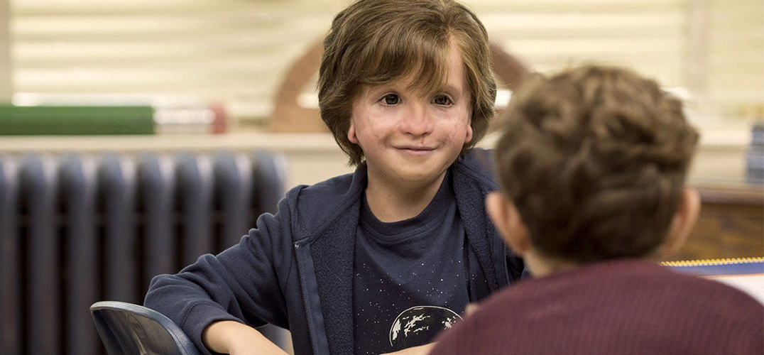 奇迹男孩读后感400,wonder奇迹男孩精读课