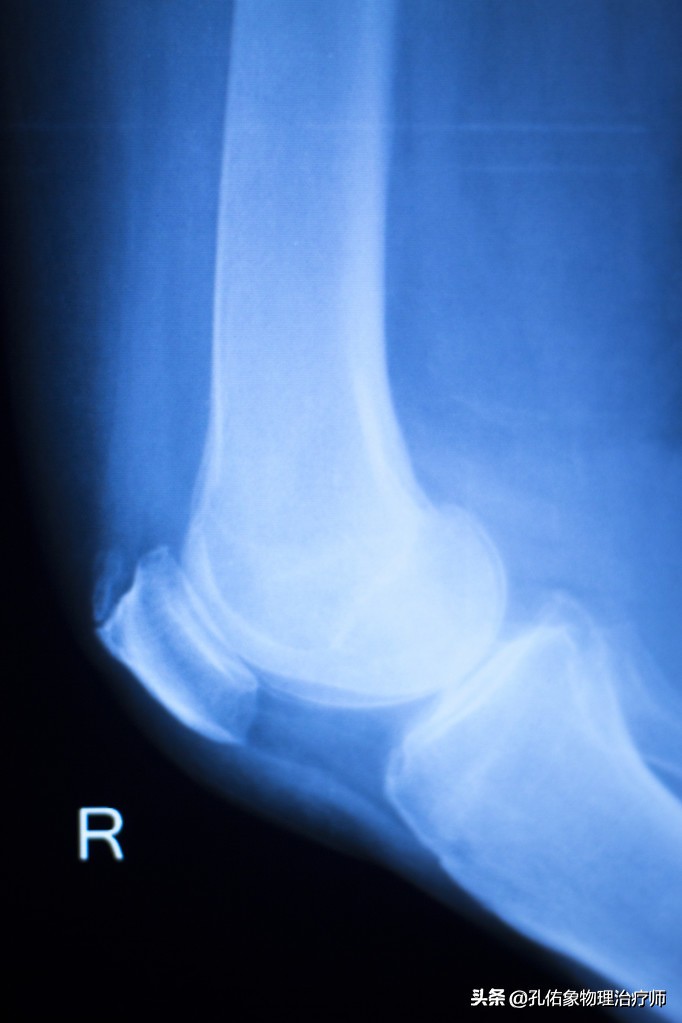 膝痛一招教你解决,膝痛怎样锻炼
